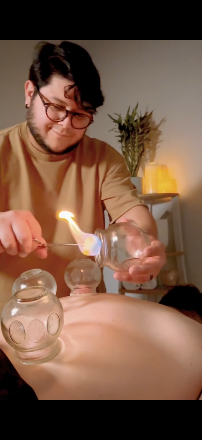Manolo performing fire cupping